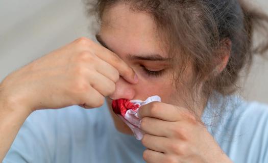 Person with bloody tissue up against their nostril, pinching their nose to stop a nosebleed