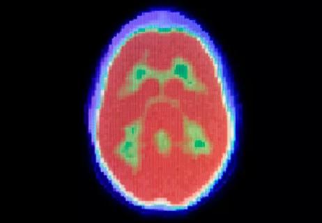 Brain scanning