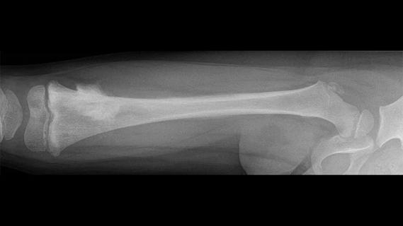 X-ray showing leg bones