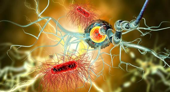 23-NEU-3813861 multiple-sclerosis-patient_650x450