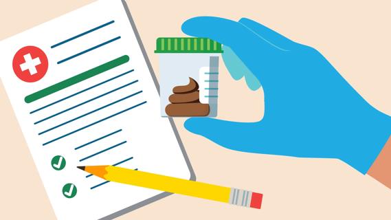 Gloved hand holding container with a fecal sample