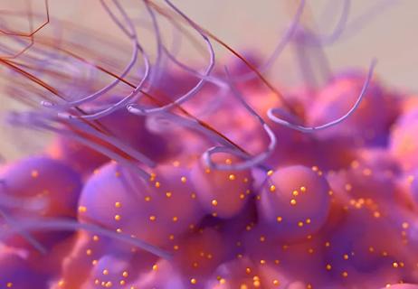 Cancer cell, cell grow out of control and become invasive