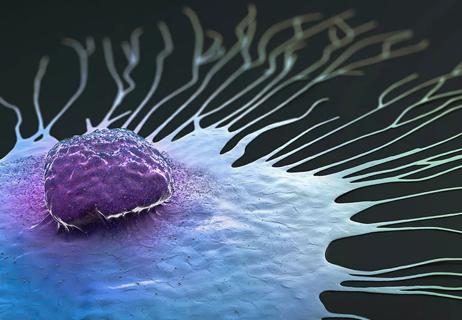 Breast cancer cell spreading