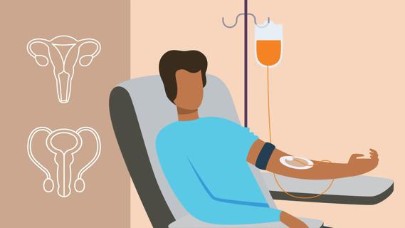 Person having chemo treatment, with male and female reproductive organs nearby
