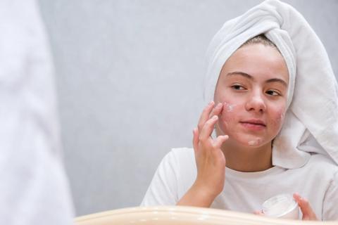 Young woman putting face cream on acne