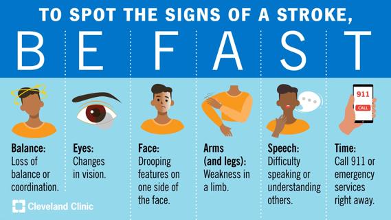 Graphic of stroke signs: BE FAST: Balance, Eyes, Face, Arms, Speech, Time