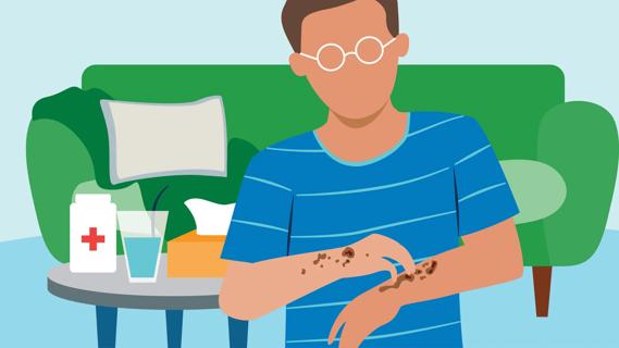 Person scratching at rash on arms, with medicine and tissues on coffee table