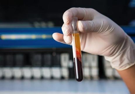 Technician holding test tube for testing blood