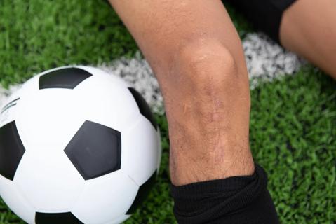 Soccer player with scar from knee surgery