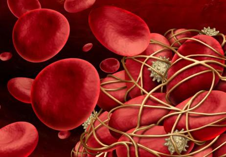 blood clots and cancer