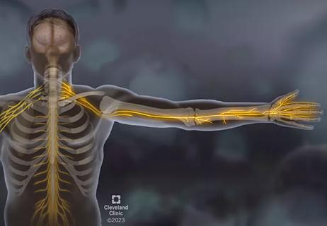Sjogren's Syndrome medical illustration
