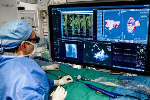 doctor looking at images on monitor during a heart procedure