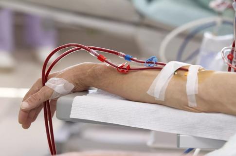 kidney haemodialysis  medicine