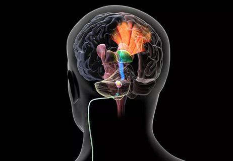 Stroke: Can Stimulating the Brain Recapture Lost Function?