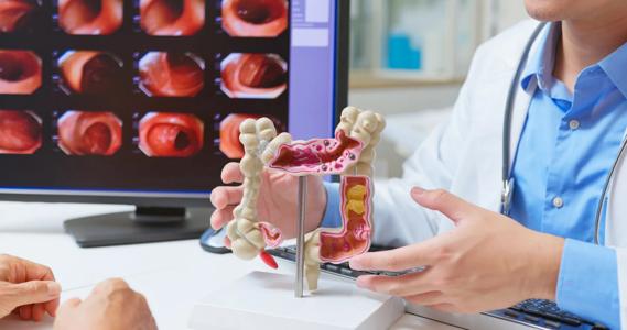 Physician using model of colon