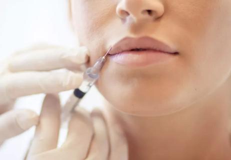 Lip filler injection on woman's mouth
