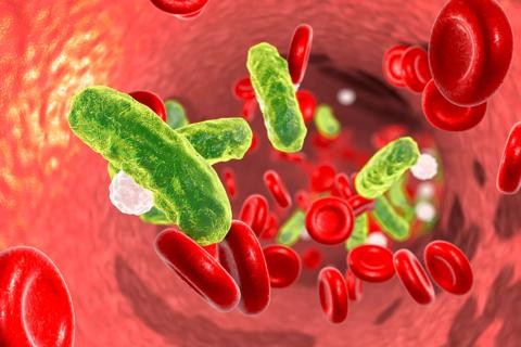 Sepsis