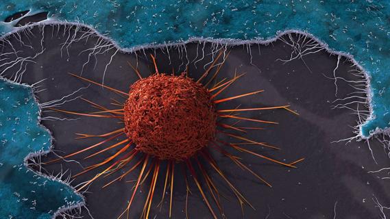 Cervical cancer cell