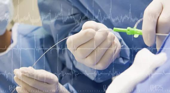 Catheter ablation