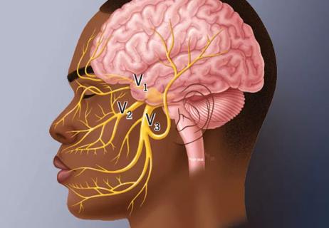 illustration showing the three branches of the trigeminal nerve
