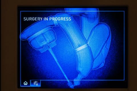 Medical illustration prostate tumor | Cleveland Clinic