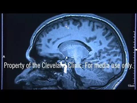 FOR MEDIA What You Can Do to Help Prevent Dementia