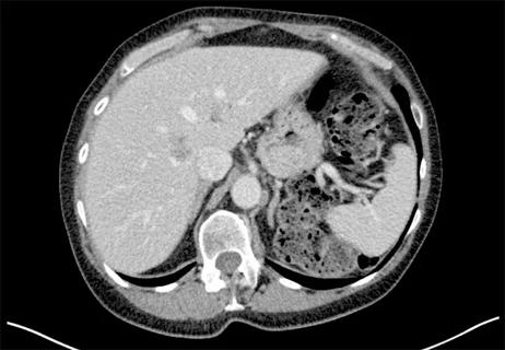 650&#215;450-Kamath-Complex-Case