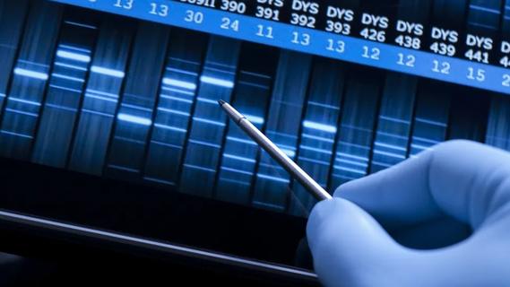 DNA test