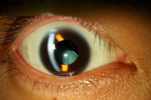 Closeup of a brown eye