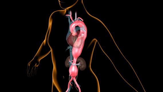 bulging aorta in stylized illustration of female adult body