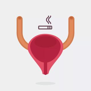 ‘Surprising Link’: Smoking and Bladder Cancer