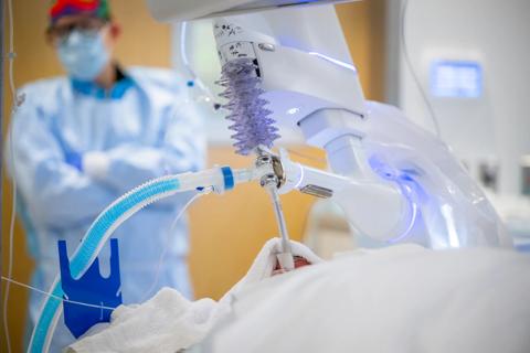 robotic tracheobronchoplasty