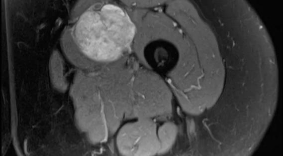 Leitman-Inset-690x380pxl