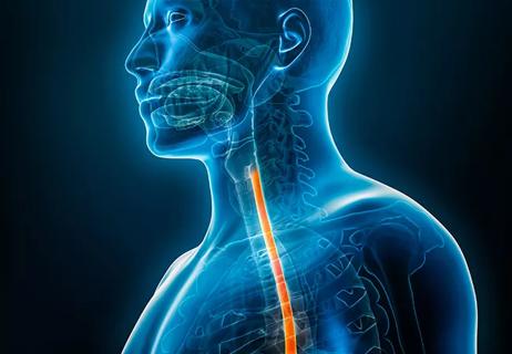 3D rendering of upper esophageal reflux in a male