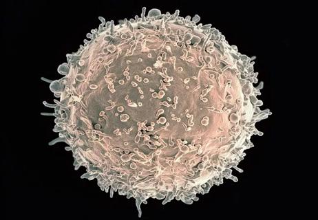 human-b-lymphocyte from NIAID 650&#215;450