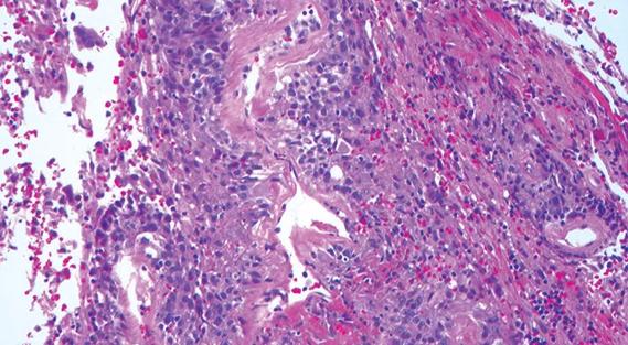 Pathology Slide_Langford_Hoffman_690x380pxl