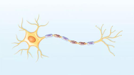 neuron affected by neuromyelitis optica