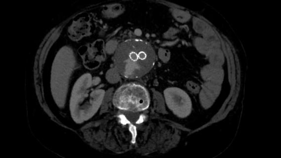 scan of the inner organs of the human midsection