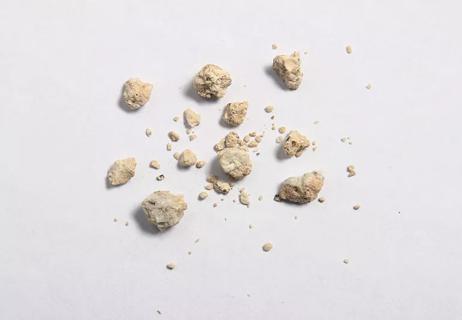 Close-up photo of kidney stones