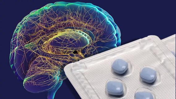 illustration of an alzheimer brain and a packet of sildenafil pills