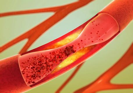 blood vessels