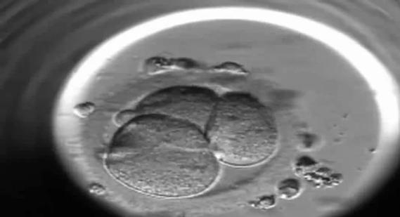 18-OBG-1361 embryo