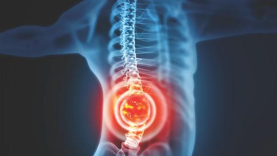 Illustration of spine x-ray with radiating red light indicating pain