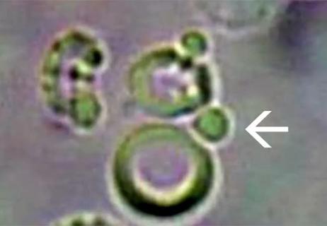650&#215;450-Urine-Micro