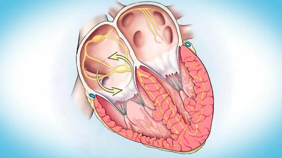 heart illustration with circular arrows in right upper chamber