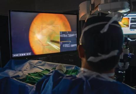 A Cleveland Clinic Cole Eye Institute ophthalmologist uses intraoperative OCT during retinal surgery.