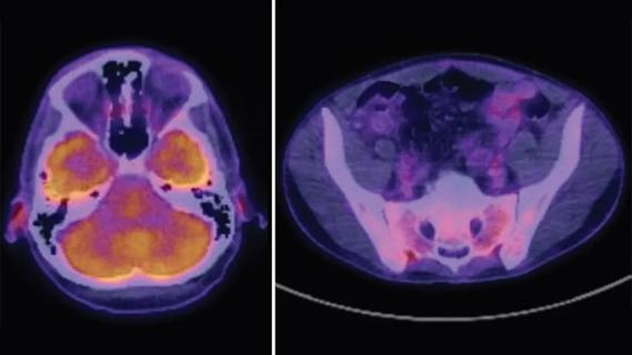 scan images of auditory canal and sacroiliac joints