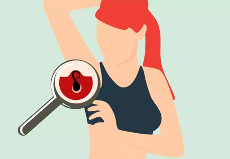 A person holds up their arm and inspects an ingrown hair on their armpit.
