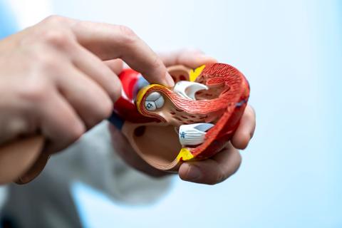 22-HVI-2935058_mitral-valve-endocarditis_650x450