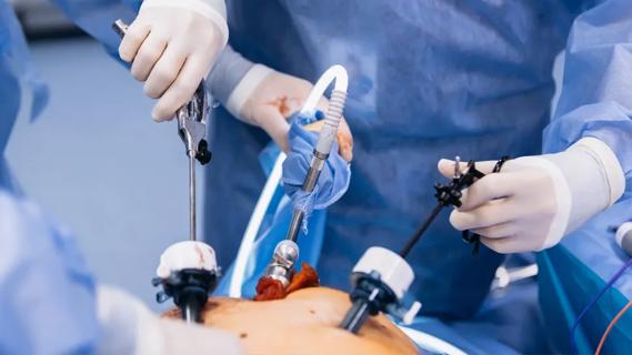 Closeup of surgeons working in abdominal area
